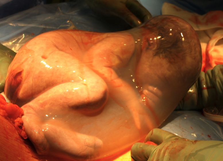 Est-ce que faire du sport nettoie les poumons ?