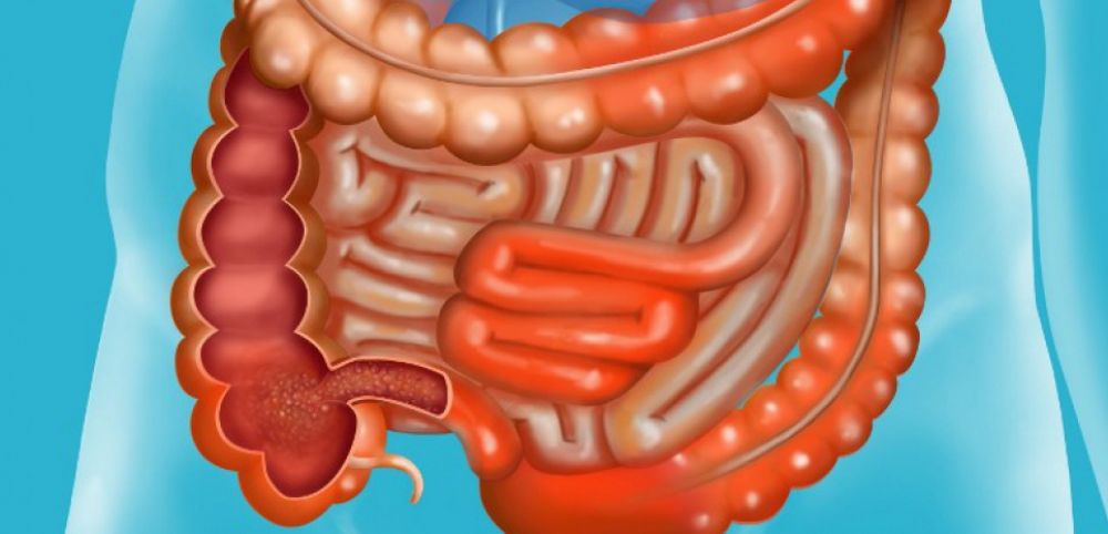 Quelle est la maladie de Messie ?