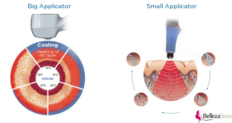 How does the elite division work?