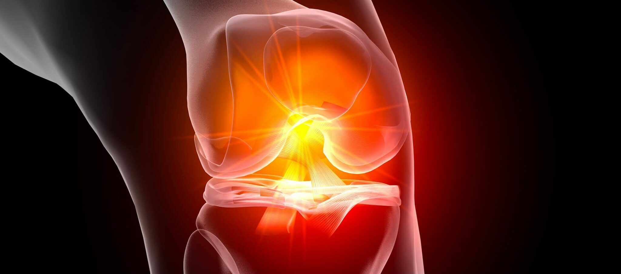 Comment savoir si ligament genou sont touche ?