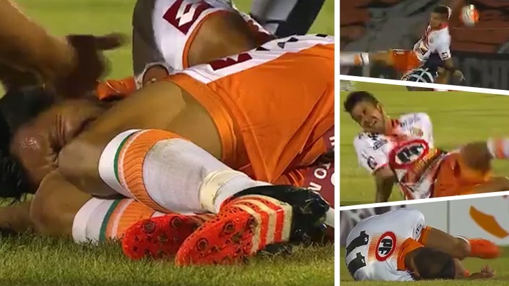 Comment se Remet-on d’une fracture du bassin ?