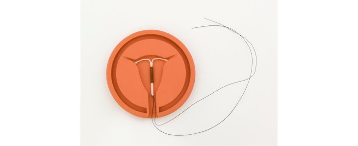 Est-ce que Roaccutane rend stérile ?