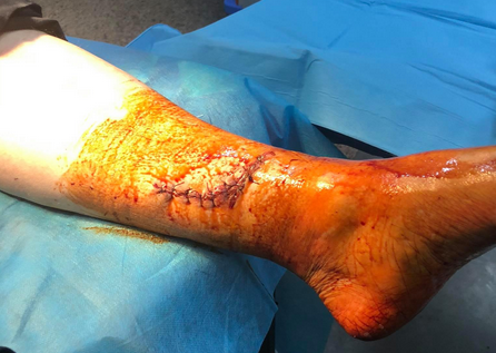 Quel est le salaire de Youcef Atal ?