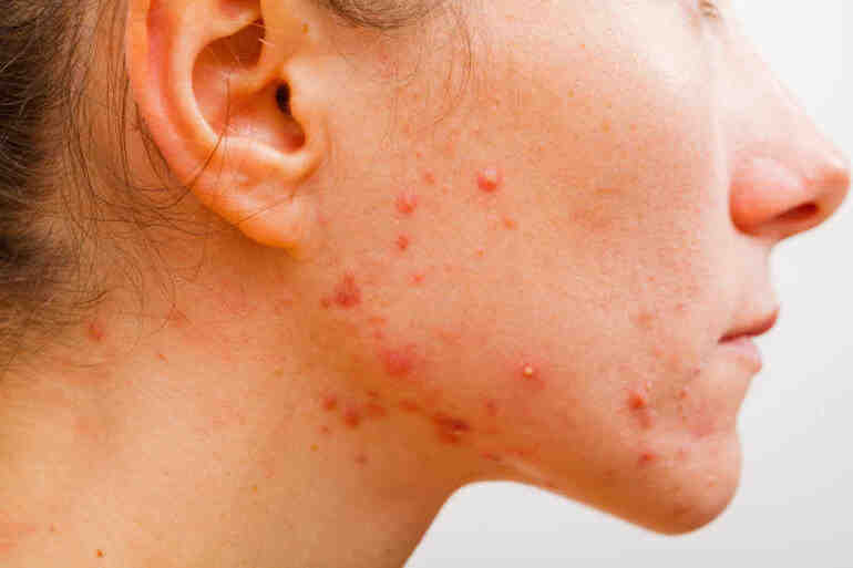 Quel est l’âge de Benzema ?