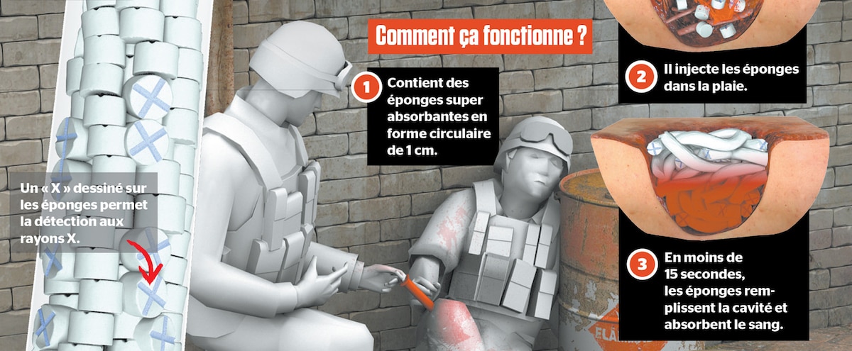 Pourquoi Faut-il retirer la balle ?