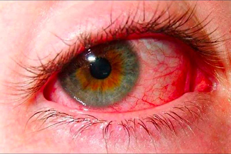 Quel est le vrai nom de Rouge dans Fort Boyard ?