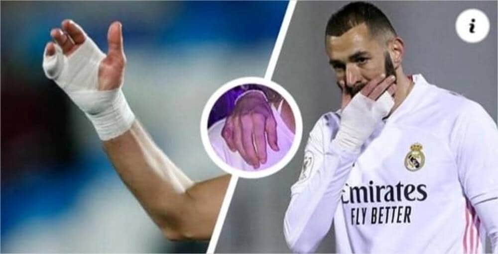 Pourquoi se bander le poignet ?